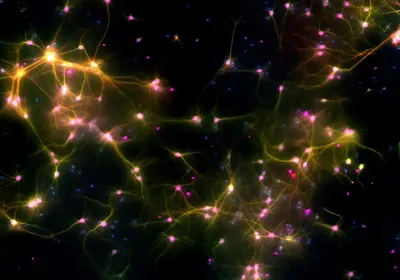 This is DishBrain, an in vitro system that combines human brain cells with artificial intelligence technology, which researchers at Australian biotech Cortical Labs recently trained to play the classic 1972 Atari video game Pong. Fluorescent markers show axons in green, neuron bodies in purple, dendrites in red, and all other cells in blue. Where multiple markers are present, colors are merged and typically appear as yellow or pink. Posted: October 12, 2022